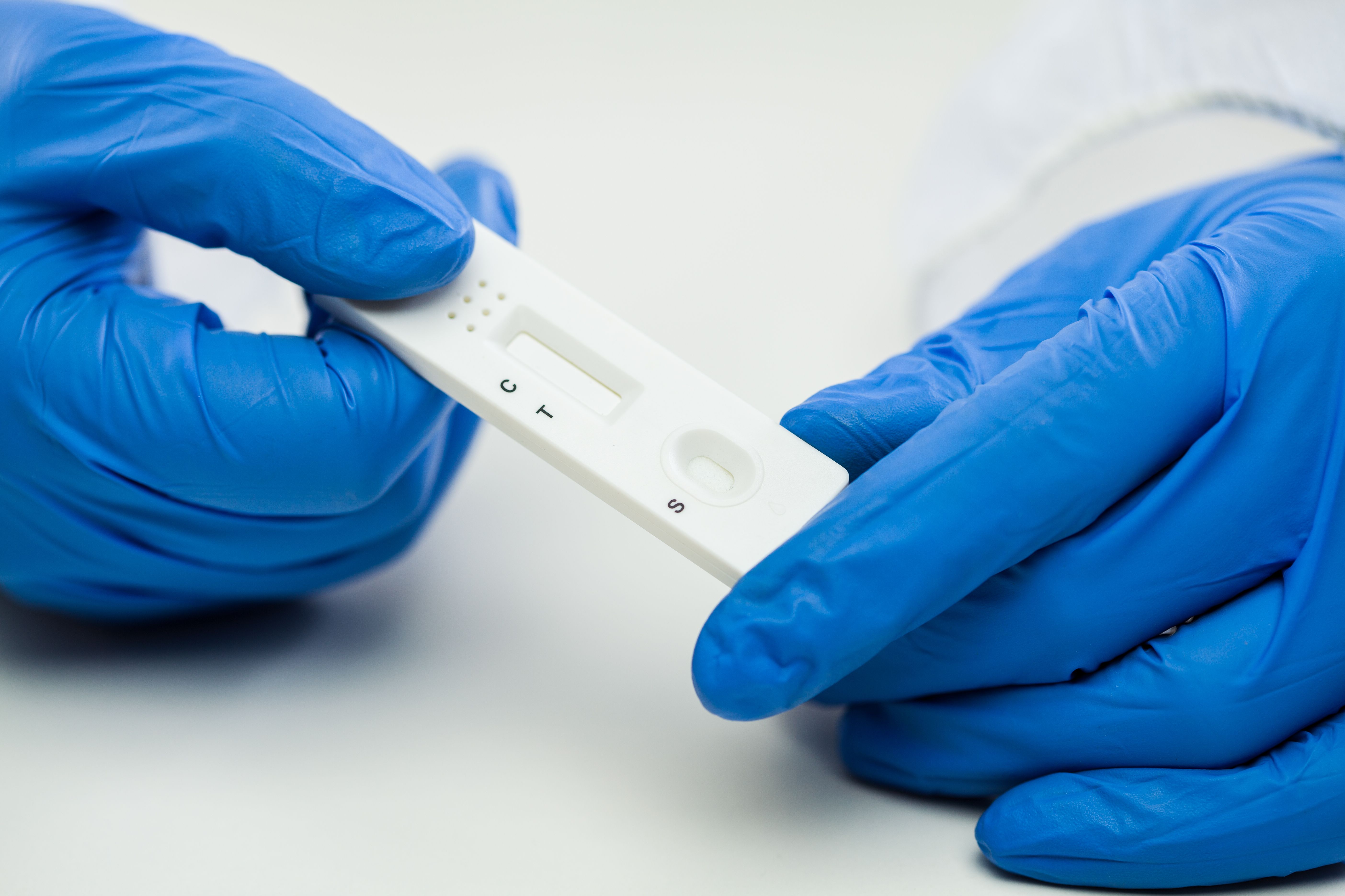 Más pruebas COVID-19 en las farmacias de Pontevedra
