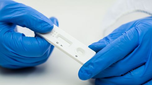 Más pruebas COVID-19 en las farmacias de Pontevedra