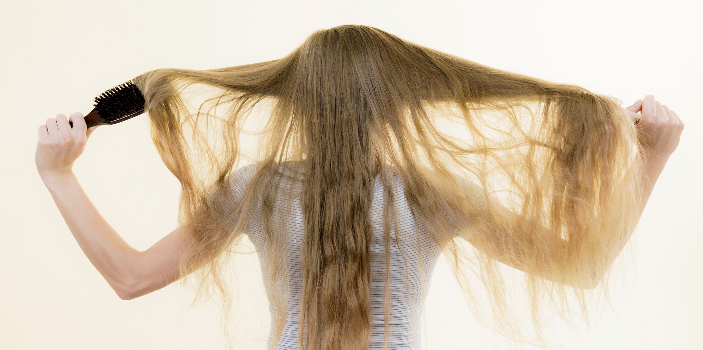 Alopecia