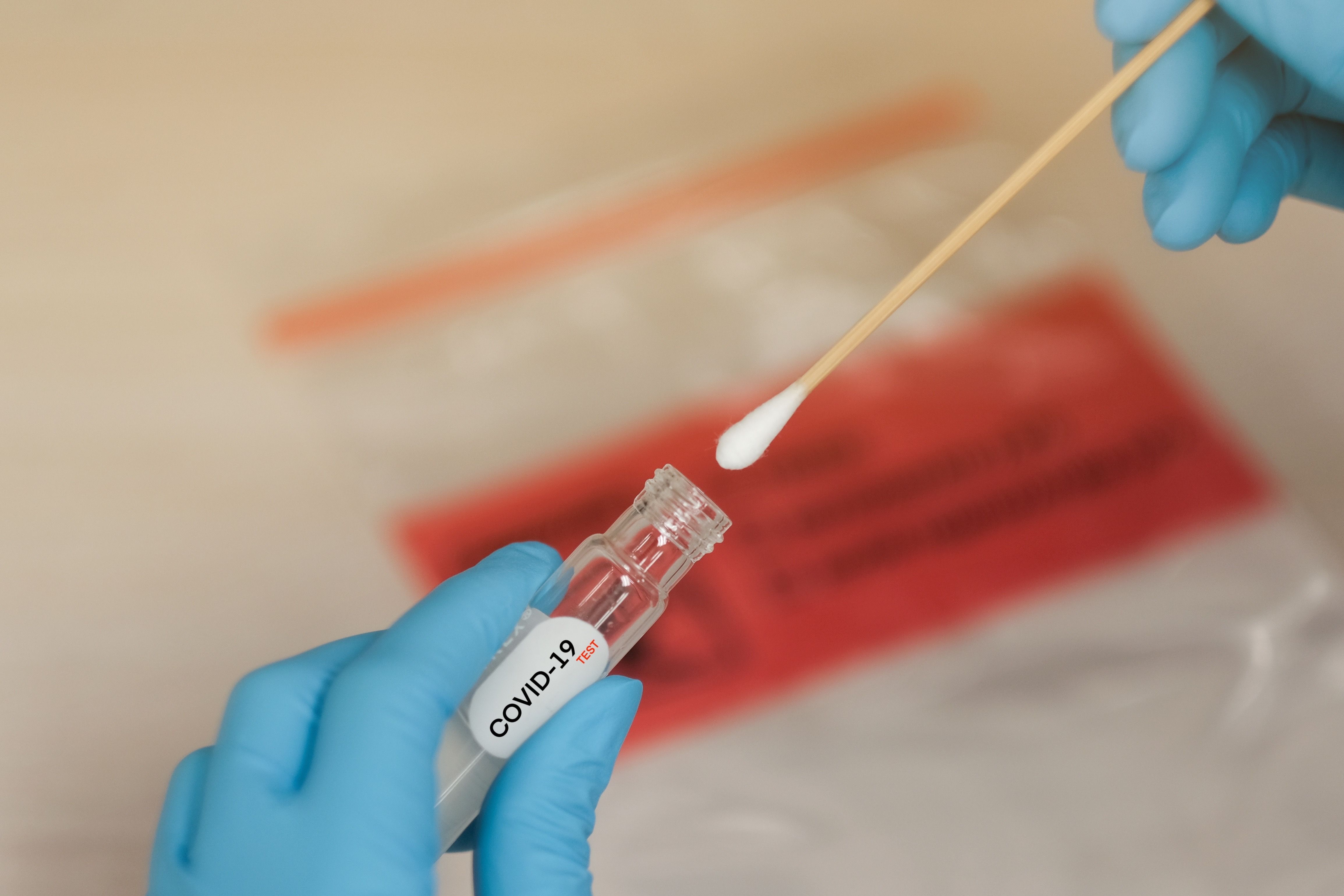 Test libres COVID-19, buena acogida en las farmacias
