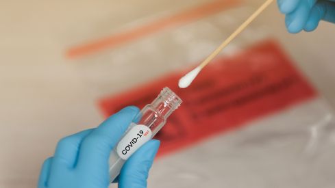 Test libres COVID-19, buena acogida en las farmacias