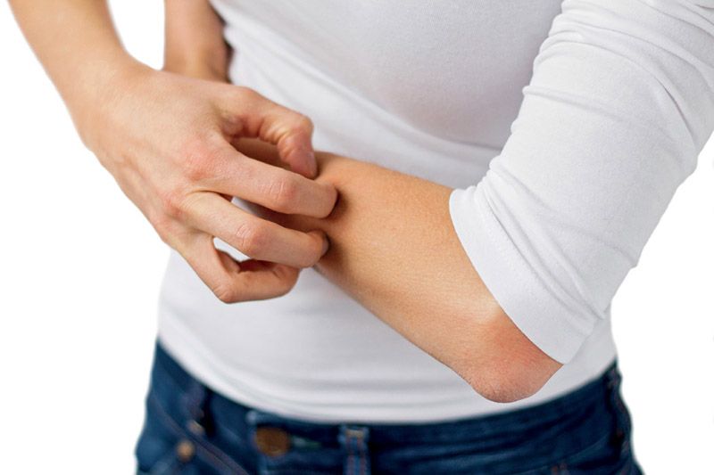 Tengo la piel inflamada y pica, ¿puede darme algo que me alivie?