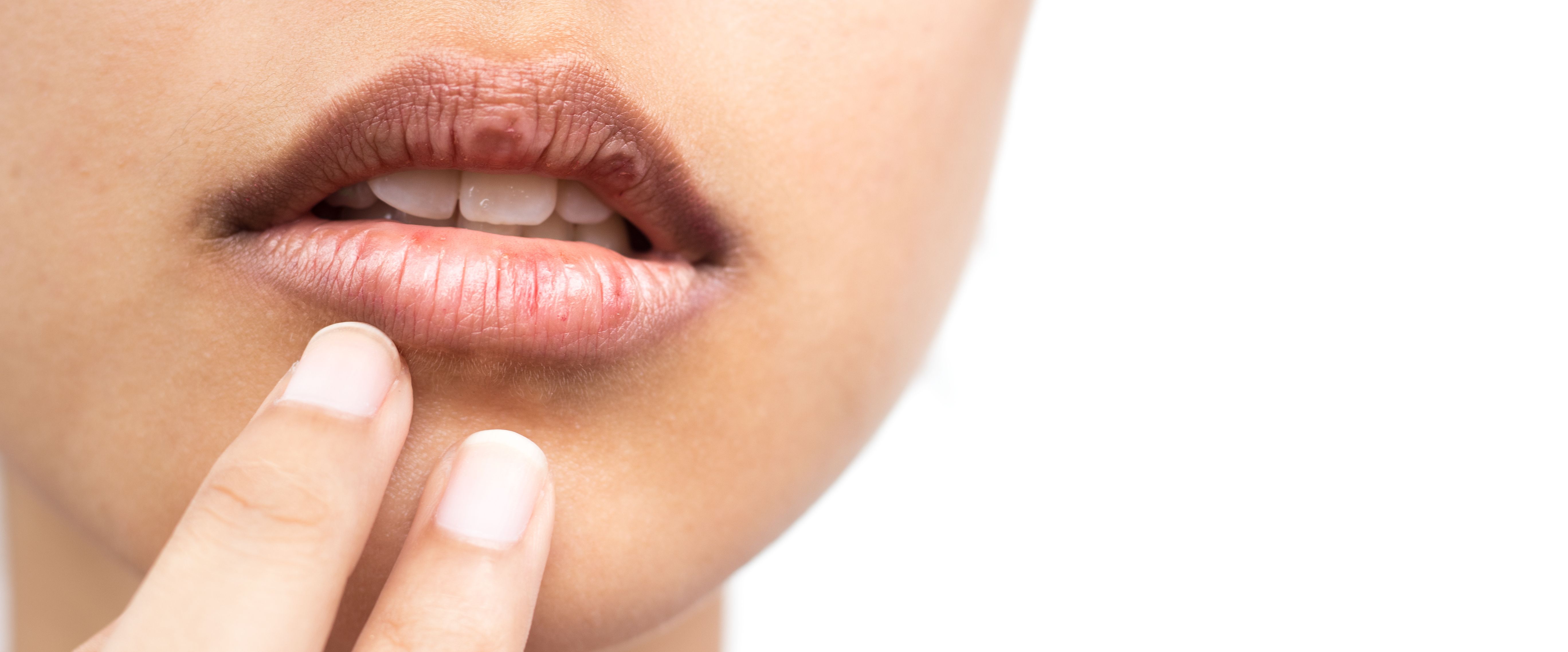 © Shutterstock 