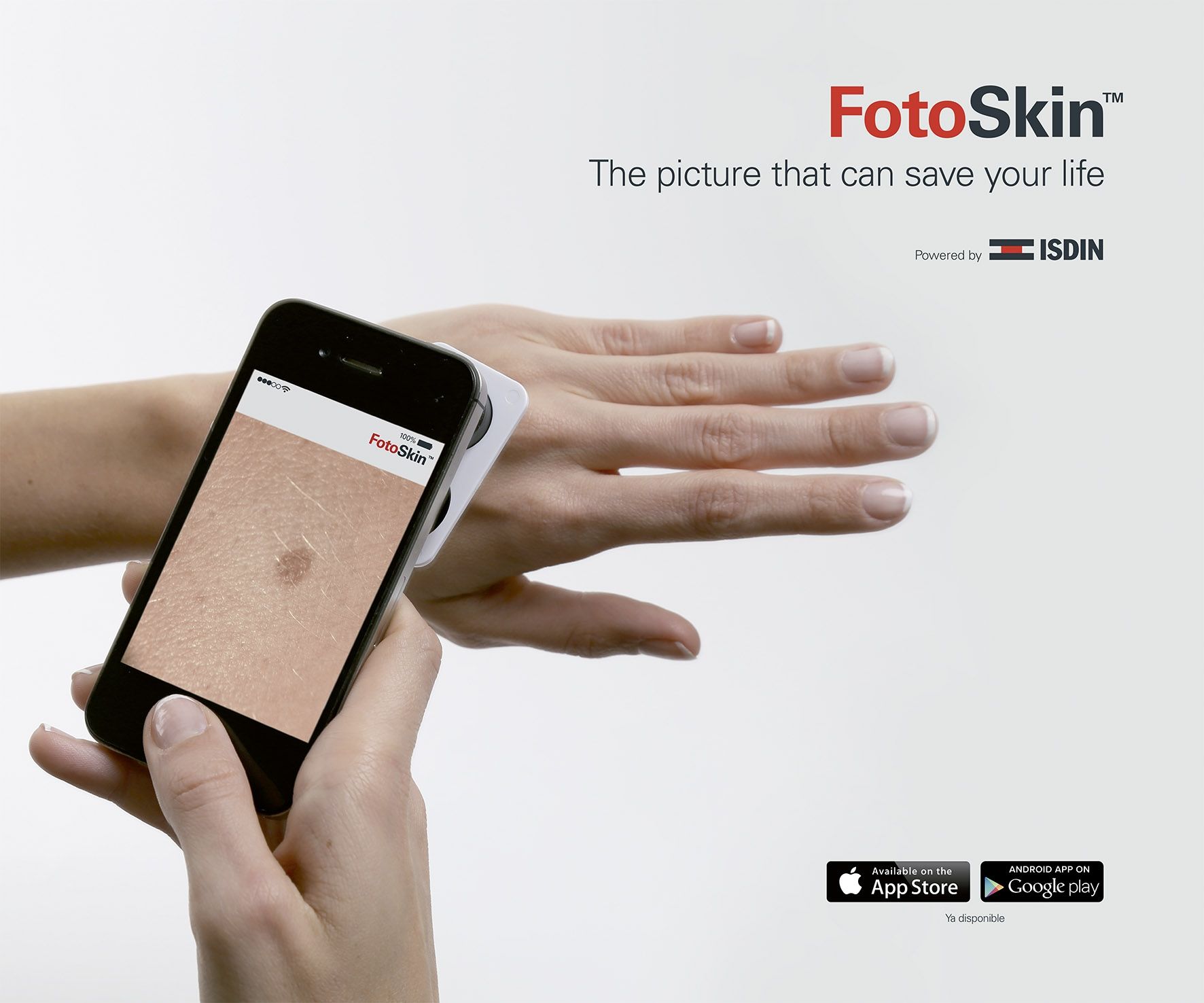 FotoSkin, la primera app gratuita que ayuda al diagnóstico precoz del cáncer de piel FotoSkin, la primera app gratuita que ayuda al diagnóstico precoz del cáncer de piel