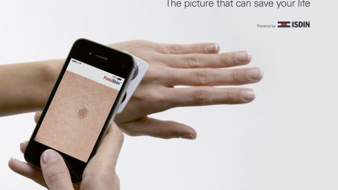 FotoSkin, la primera app gratuita que ayuda al diagnóstico precoz del cáncer de piel FotoSkin, la primera app gratuita que ayuda al diagnóstico precoz del cáncer de piel