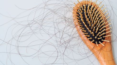 Caída del cabello en la mujer