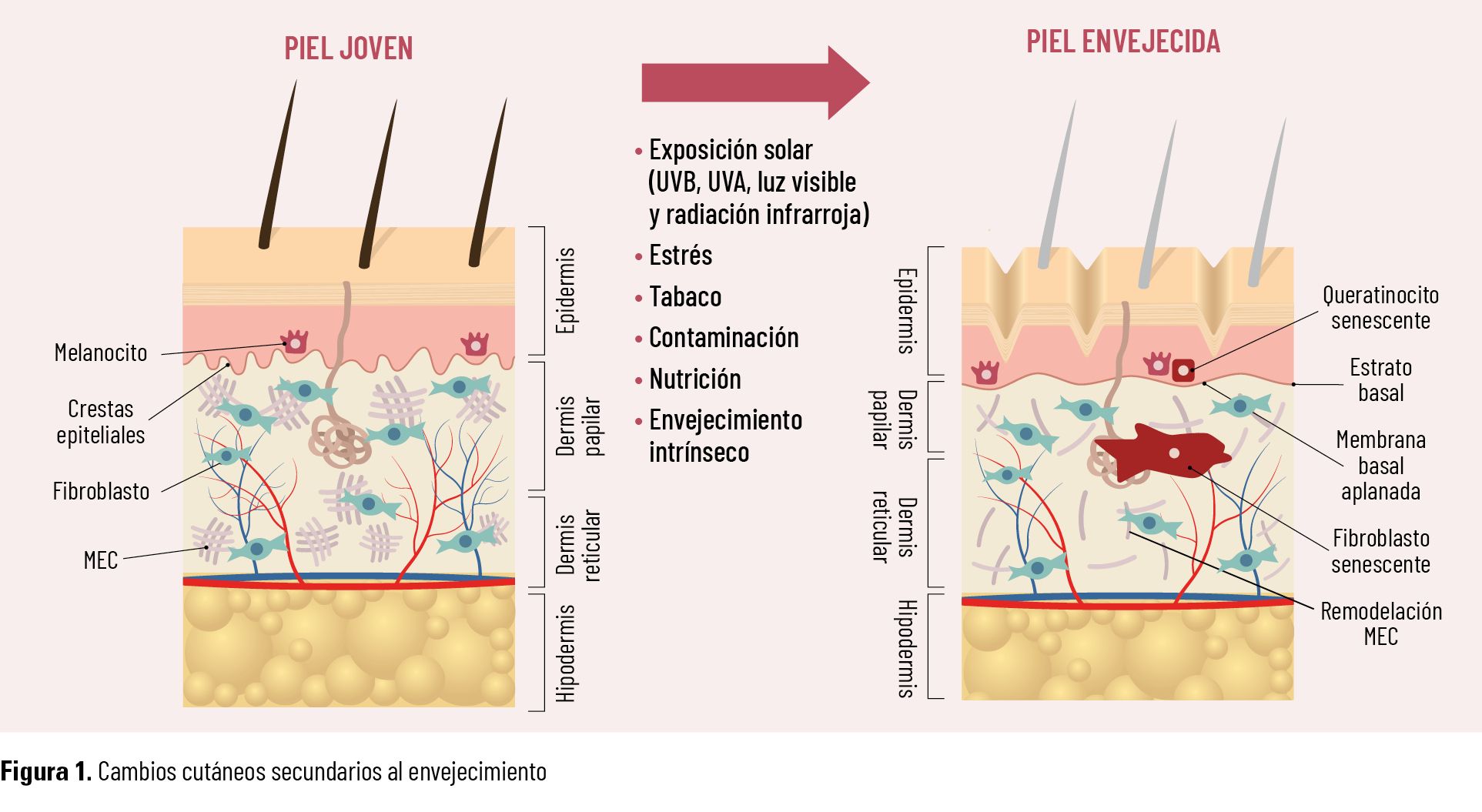 Figura 1. Cambios cutáneos secundarios al envejecimiento