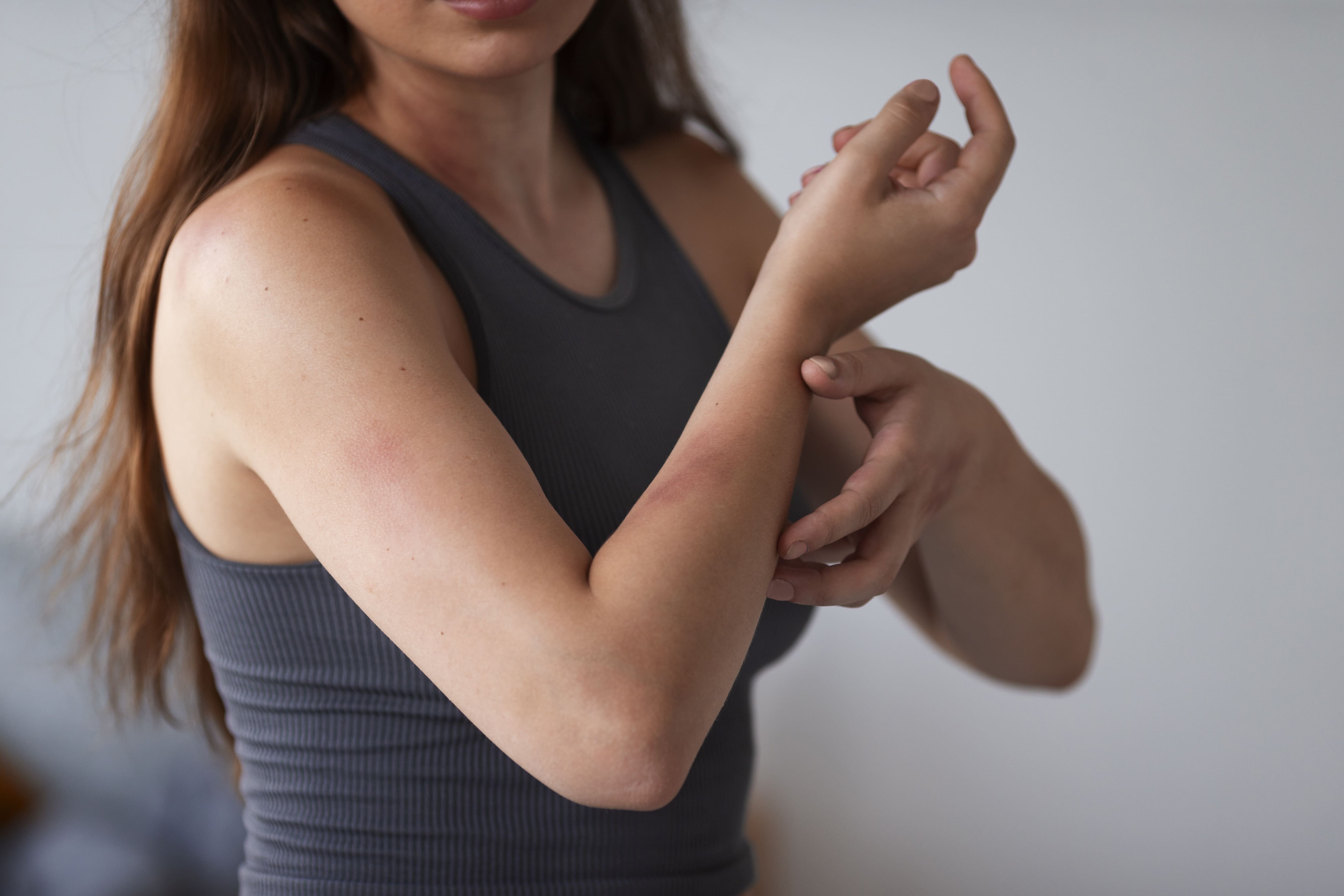 Marnys proporciona consejos prácticos para calmar el picor y la irritación en pieles atópicas