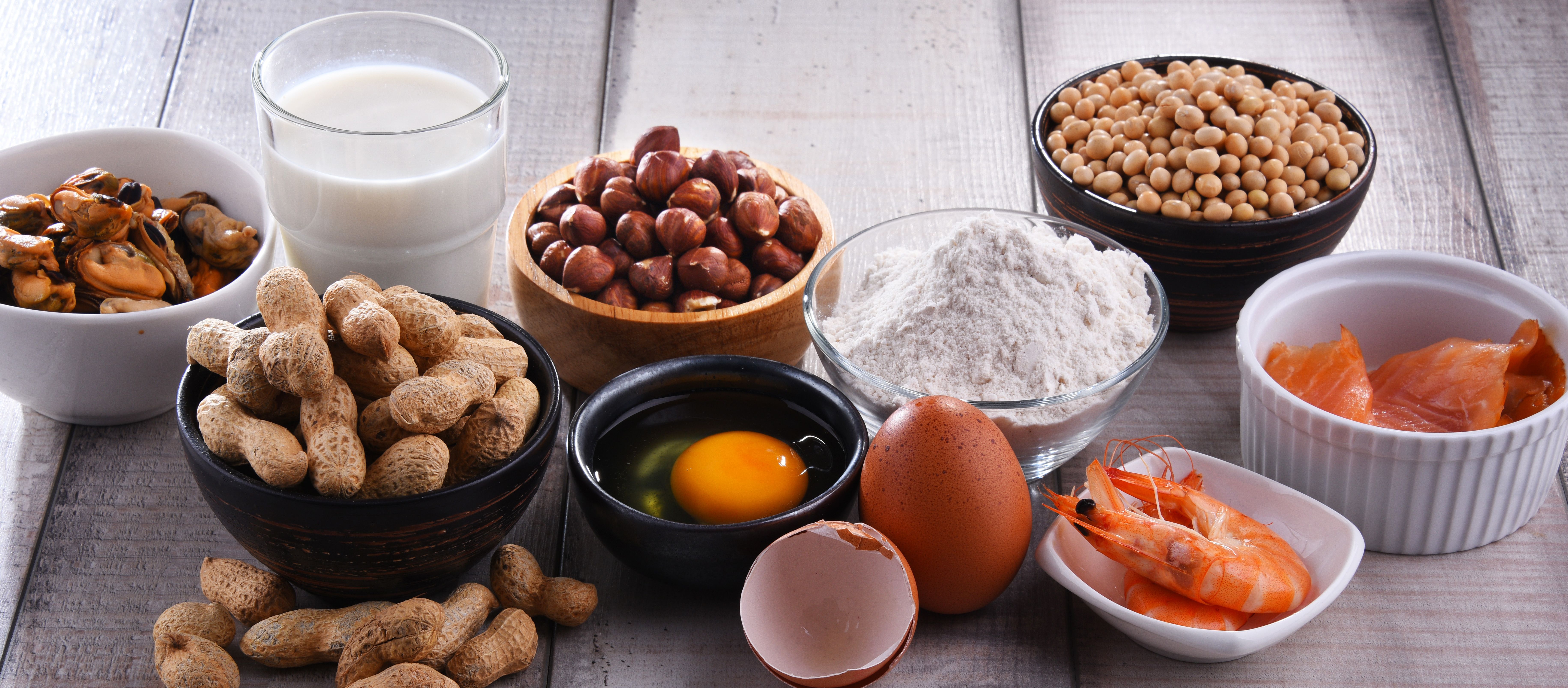 Alergias, intolerancias y aditivos alimentarios centrarán el primer encuentro de Alimentación y Farmacia de Castilla y León