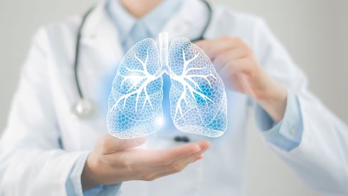 Johnson & Johnson recibe la opinión positiva para amivantamab en combinación con quimioterapia para el cáncer de pulmón no microcítico