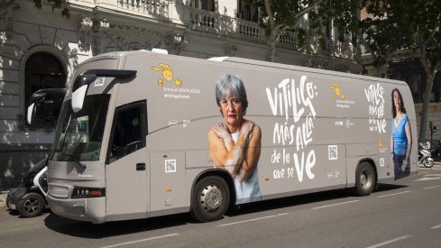 El vitíligo es la enfermedad despigmentante más frecuente, afectando a un 1,6% de la población