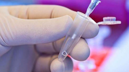 Curso sobre aspectos básicos en el desarrollo de nanomedicamentos