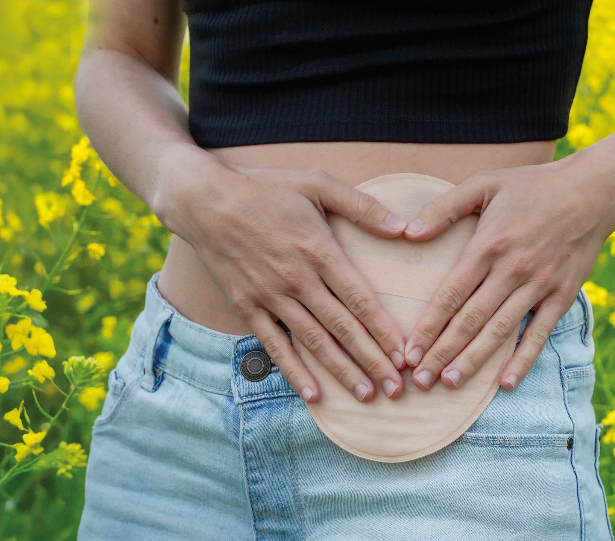 Atención al paciente ostomizado desde la farmacia