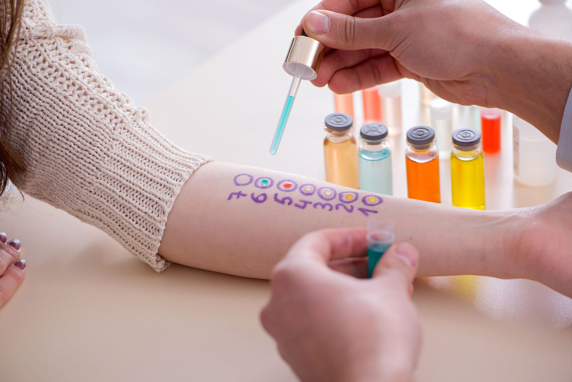 La prueba más extendida para el control de las alergias  en la práctica clínica es el prick-test o prueba de punción