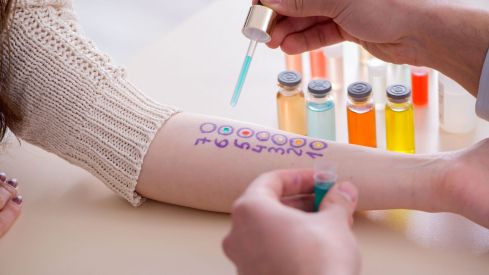 La prueba más extendida para el control de las alergias  en la práctica clínica es el prick-test o prueba de punción