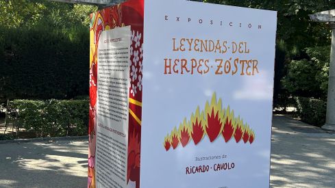 Imagen de la exposición  leyendas del Herpes Zóster, una iniciativa de sensibilización que aborda esta patología desde una perspectiva cultural y simbólica.