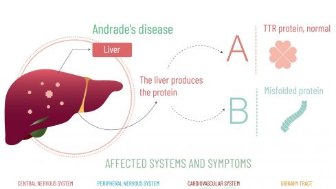 El estudio ATENAS: la experiencia de vivir con la enfermedad de Andrade
