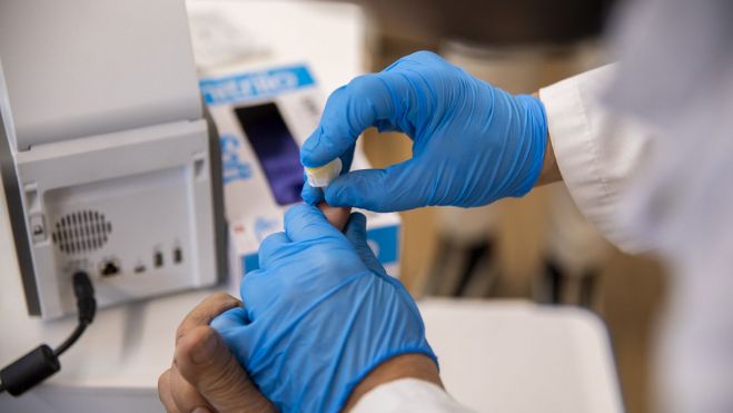 Prueba de glucemia y colesterol. Prueba de glucemia y colesterol.