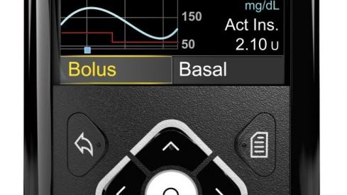 Medtronic lanza en España el nuevo sistema integrado MiniMed 640G para el tratamiento de la diabetes