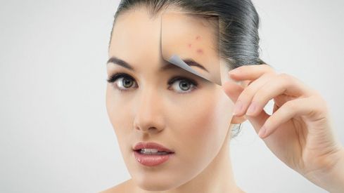 Preguntas más frecuentes en dermofarmacia
