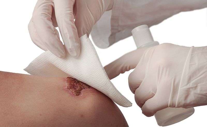 Apósitos dérmicos con agentes bioactivos especiales