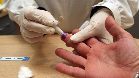Las farmacias vascas han realizado más de 18.400 pruebas del VIH desde 2009