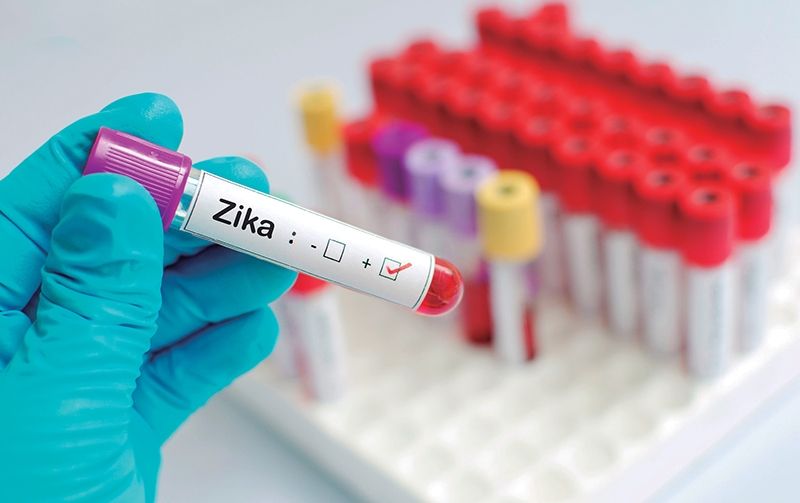 Actualización en el virus Zika