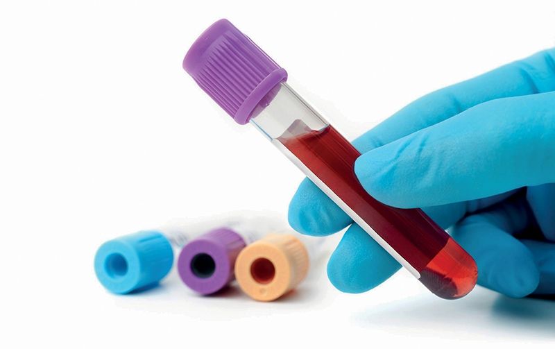CPAMS: servicio de anticoagulantes en la farmacia comunitaria