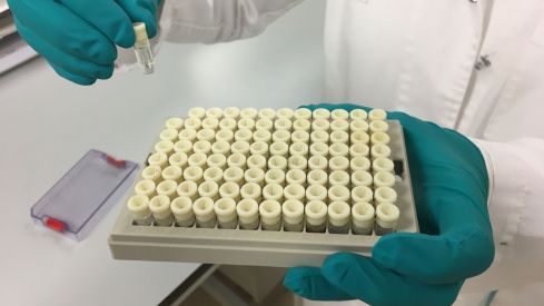 La inversión en I+D farmacéutica creció un 8% en España en 2016