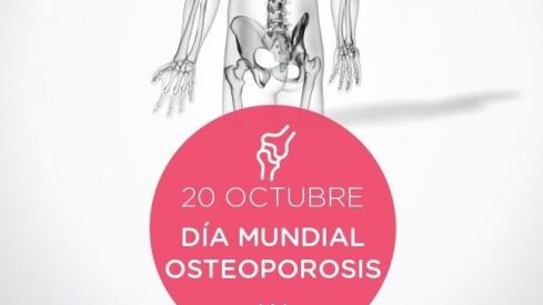 Fedefarma fomenta la detección de pacientes de riesgo de osteoporosis desde la farmacia