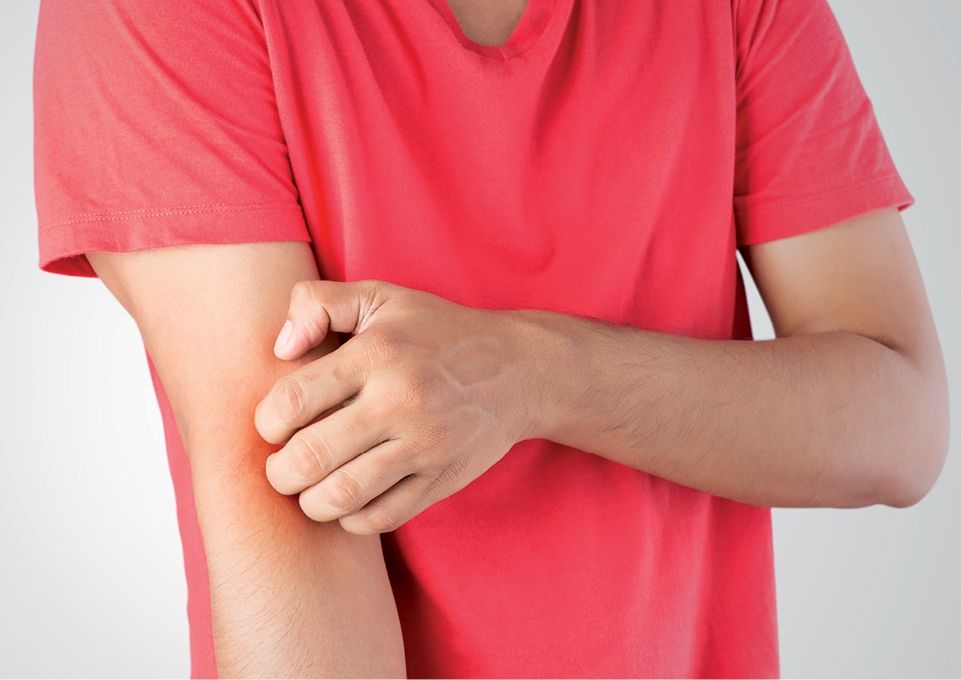 Dermatitis atópica: definición, consejos prácticos y tratamiento