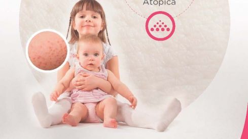 Fedefarma desarrolla una campaña de salud con motivo del Día Mundial de la Dermatitis Atópica