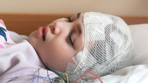 Módulo 6. Patologías neurológicas y su relación con la urgencia: epilepsia, meningitis y lesiones traumáticas