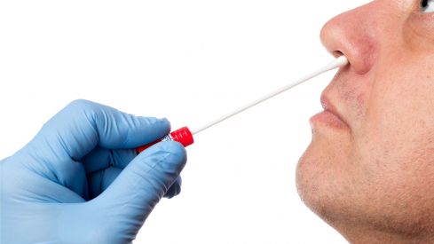 SEFAC reitera la disposición de los farmacéuticos a colaborar en la realización de test para la detección del SARS-CoV-2