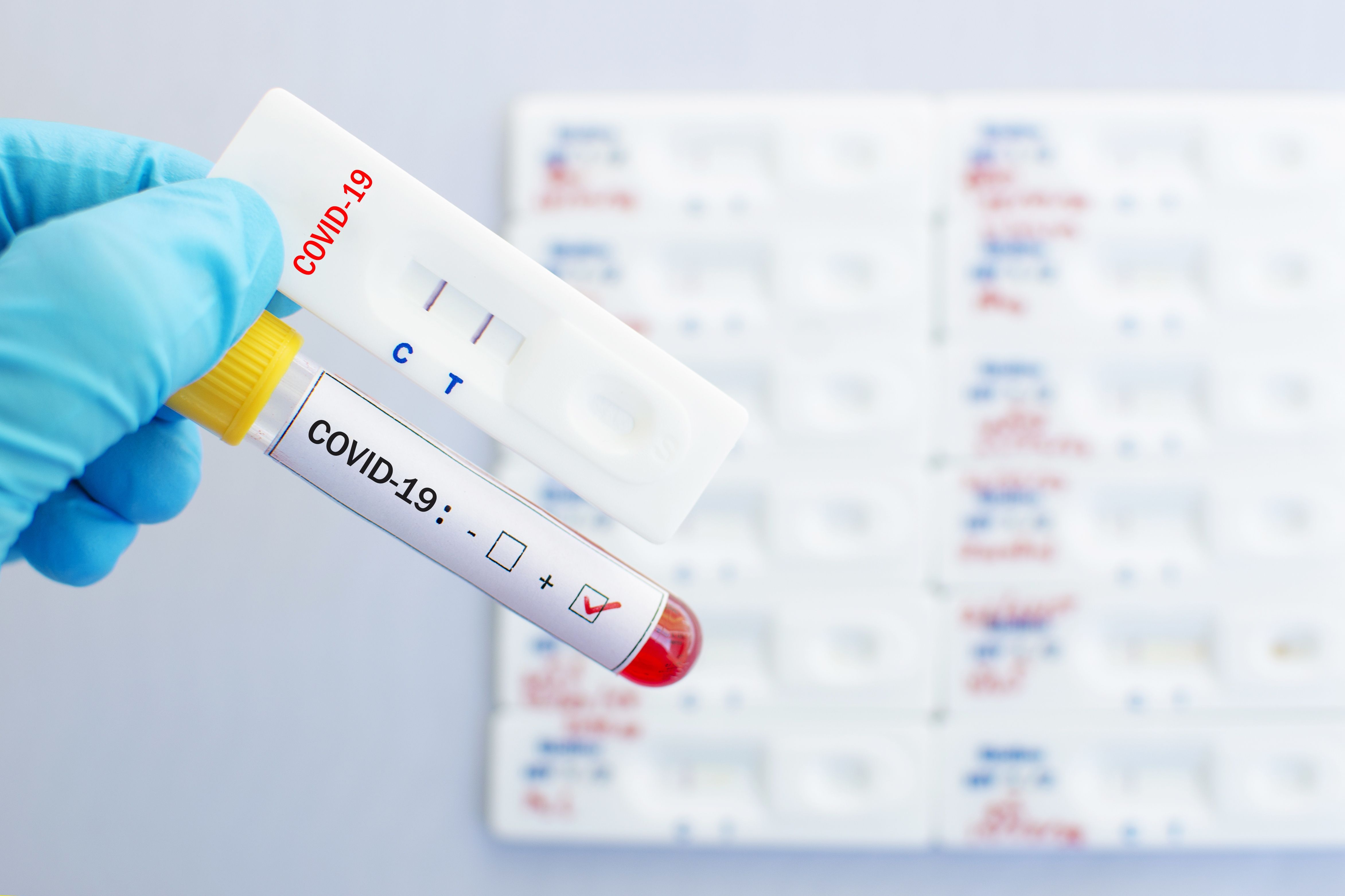 Las 10 razones de SEFAC para realizar test rápidos de detección de la COVID-19 en las farmacias comunitarias