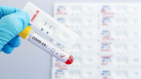 Las 10 razones de SEFAC para realizar test rápidos de detección de la COVID-19 en las farmacias comunitarias