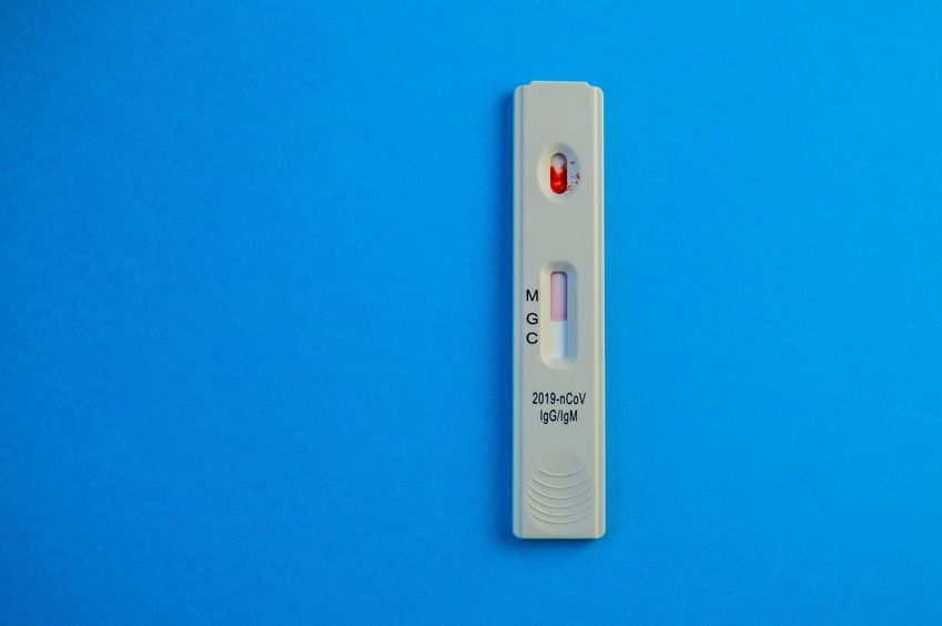 SEFAC muestra su preocupación por el inmovilismo de las administraciones para realizar test rápidos de antígenos en farmacias