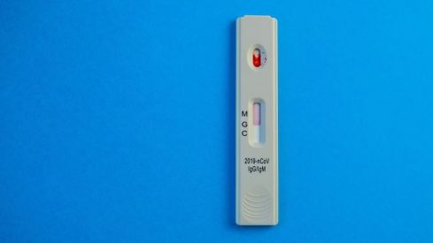 SEFAC muestra su preocupación por el inmovilismo de las administraciones para realizar test rápidos de antígenos en farmacias