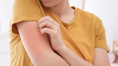 PiLeJe ofrece consejos para proteger la piel de las alergias en primavera PiLeJe ofrece consejos para proteger la piel de las alergias en primavera