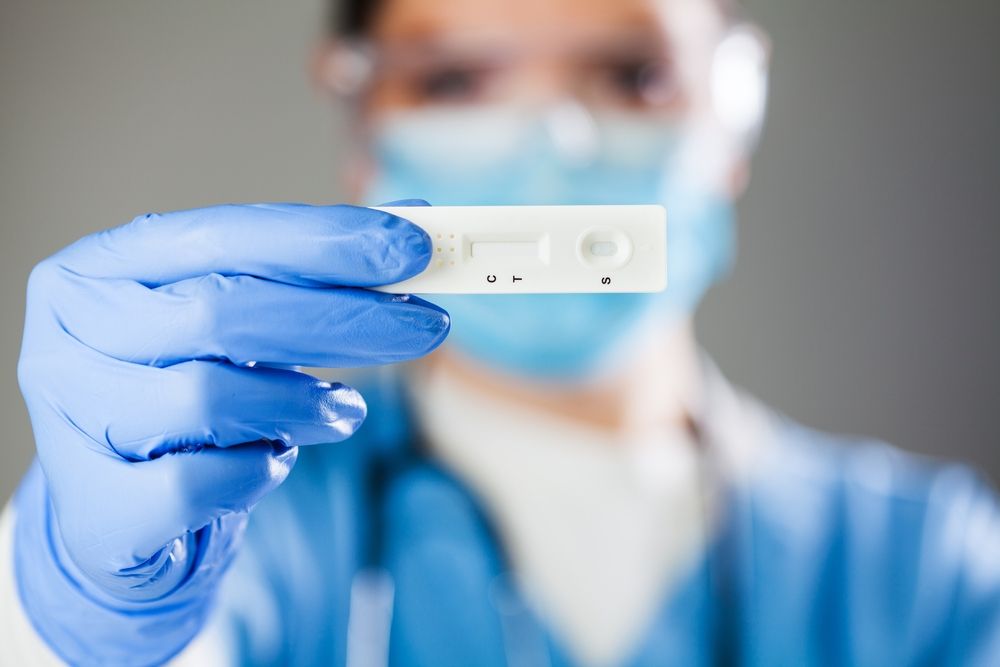 Los test de autodiagnóstico de la COVID-19 podrán comprarse en las farmacias