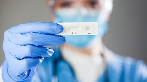 Los test de autodiagnóstico de la COVID-19 podrán comprarse en las farmacias