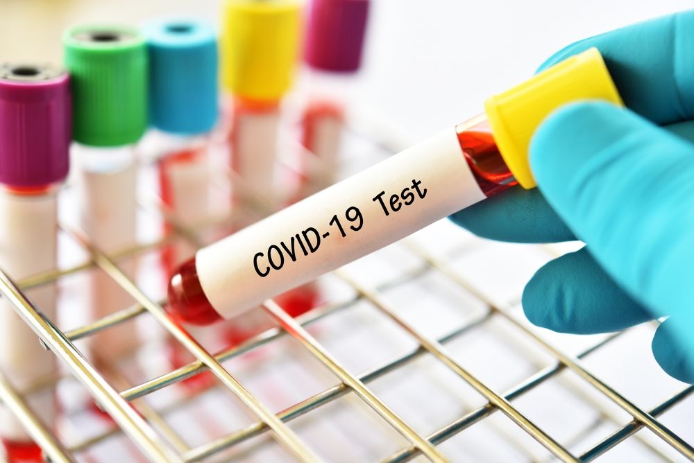 SEFAC dice sí a la dispensación de test de autodiagnóstico de COVID-19 para su realización en las farmacias