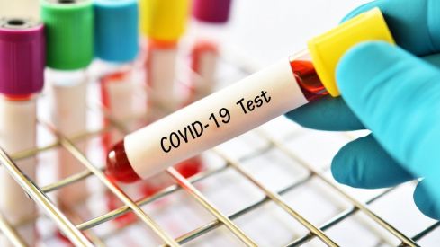 SEFAC dice sí a la dispensación de test de autodiagnóstico de COVID-19 para su realización en las farmacias