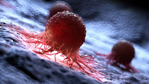 Reportaje multimedia sobre el cáncer de piel