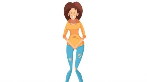 Candidiasis. Candidiasis.